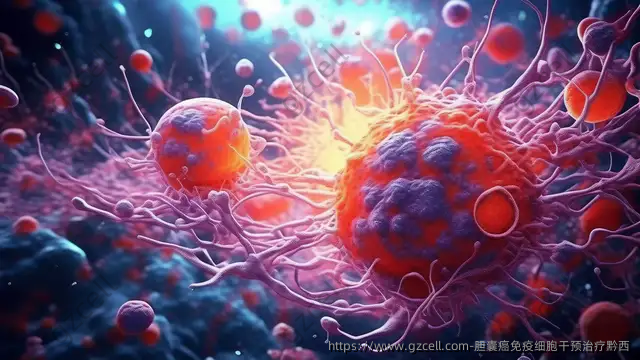 胆囊癌免疫细胞干预治疗黔西