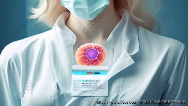 贵阳皮肤癌免疫细胞干预治疗