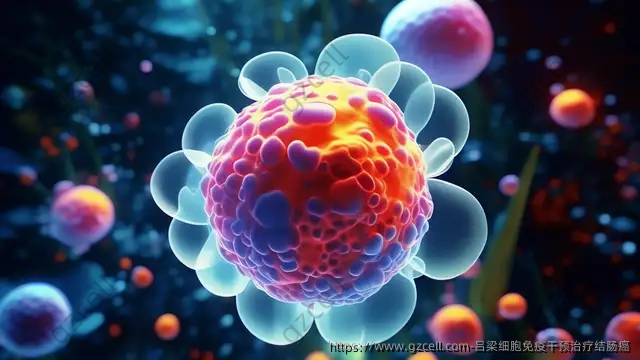 吕梁细胞免疫干预治疗结肠癌